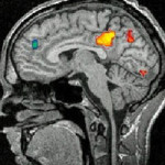 Imaging – fMRI